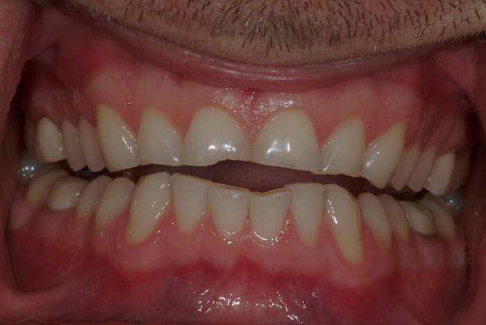 Look At Our Patients Smile Gallery-Pinnacle Dental