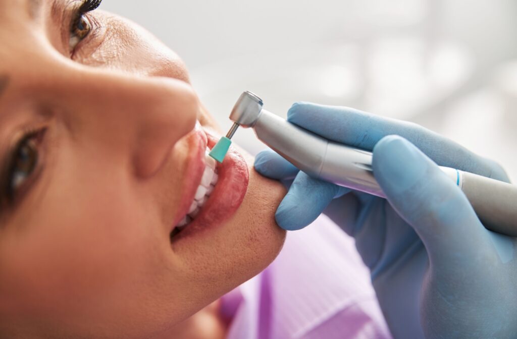 A close-up image of a persons teeth getting polished with a cup brush