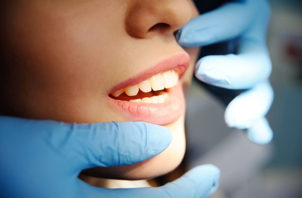 A close up of a dentist lifiting a patient lip to show their perfect teeth